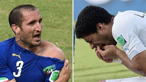 soccerbite